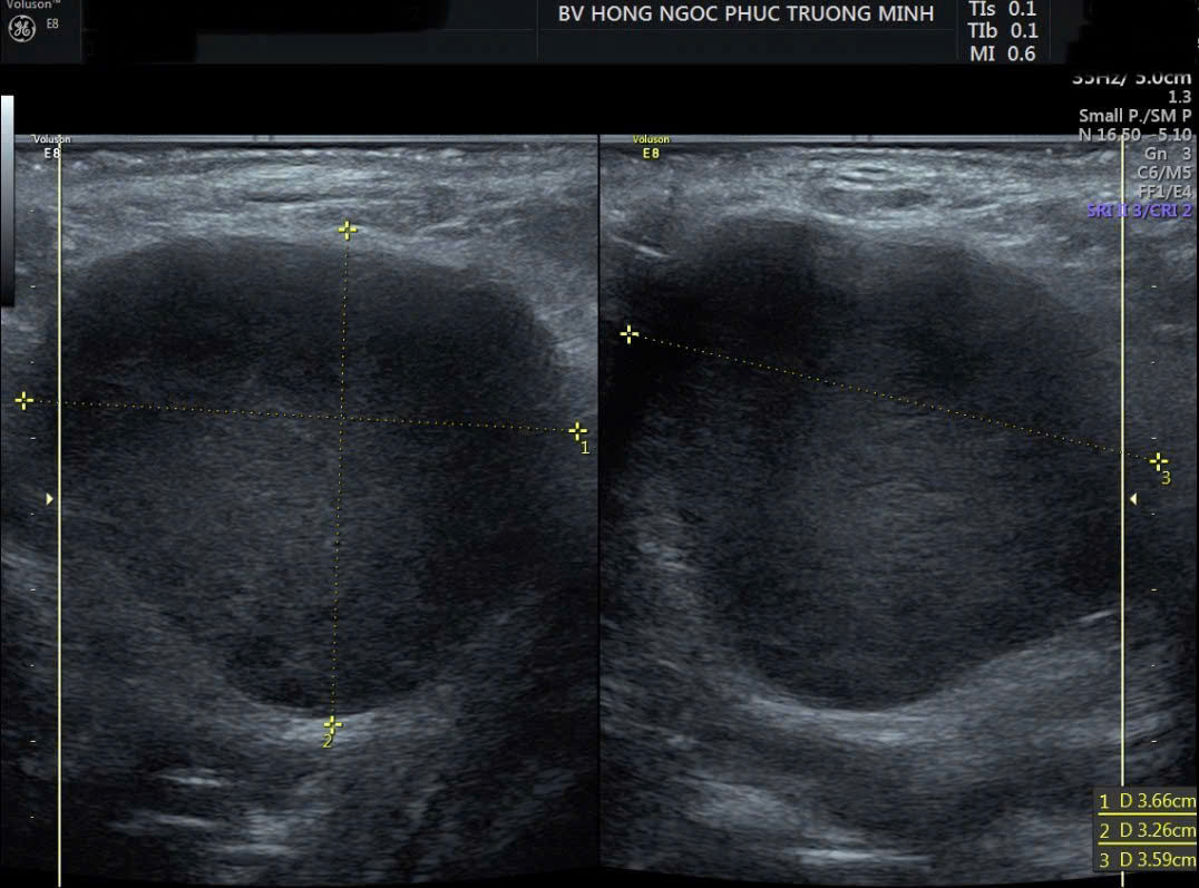 15c87061 A75b 48c9 9c19 5a749fb18243