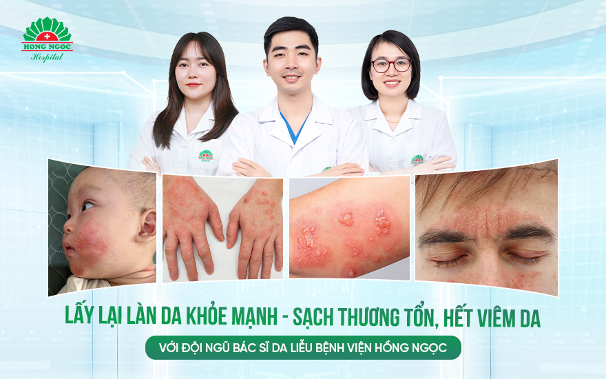 viêm da thường gặp