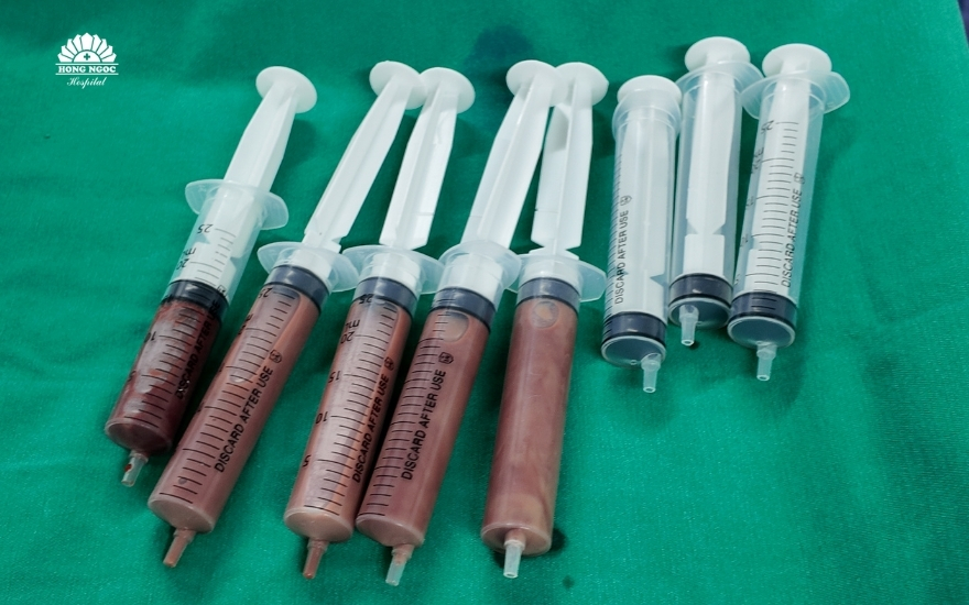 nguoi-dan-ong-nguy-kich-vi-o-ap-xe-gan-lon-chiem-gan-tron-gan-phai