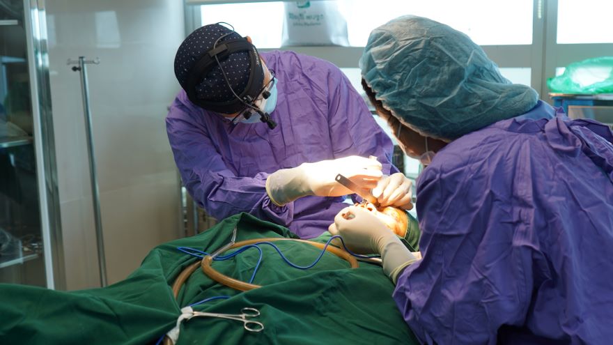 nâng mũi bán cấu trúc