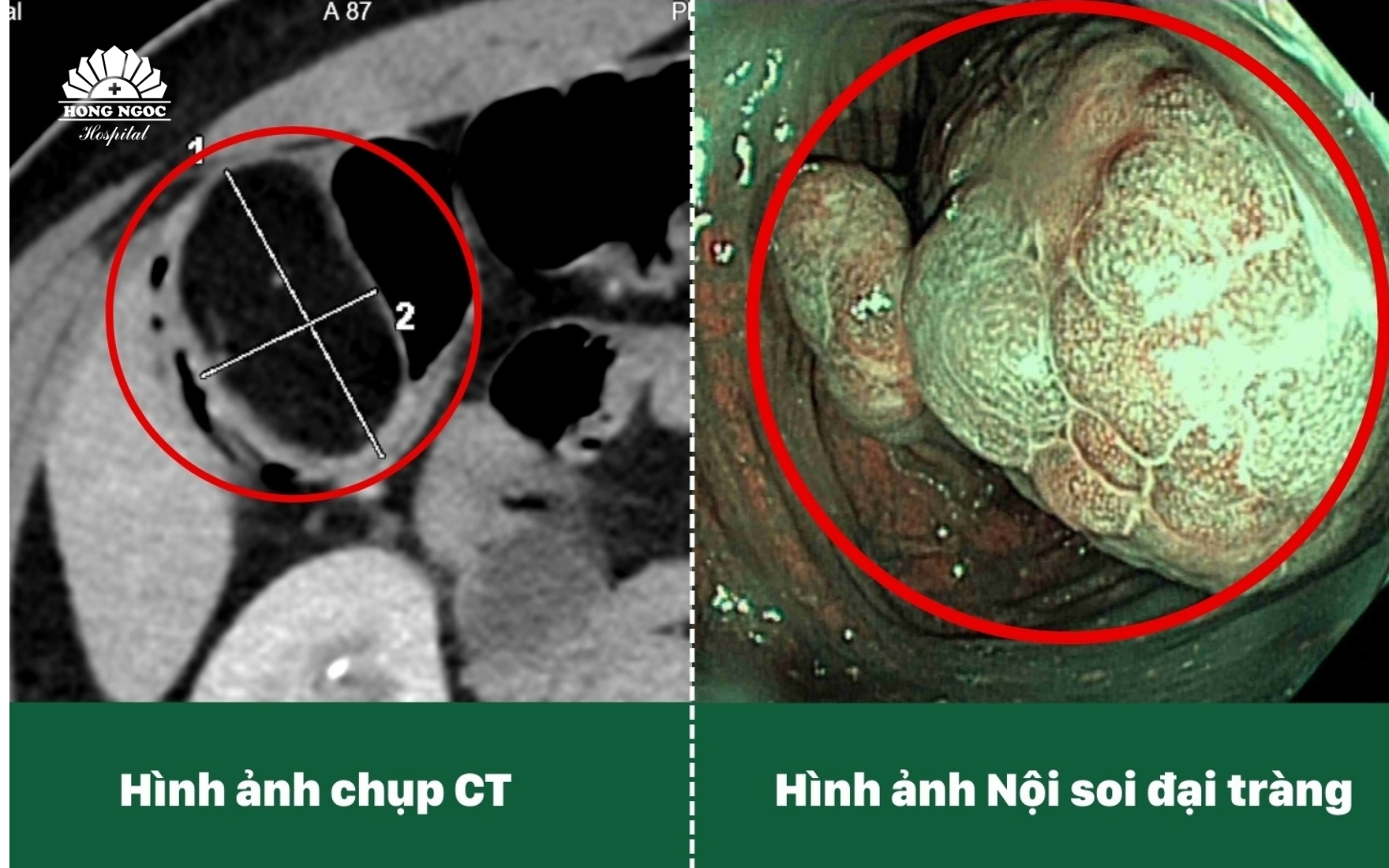 cat-u-dai-trang-cho-du-khach-canada