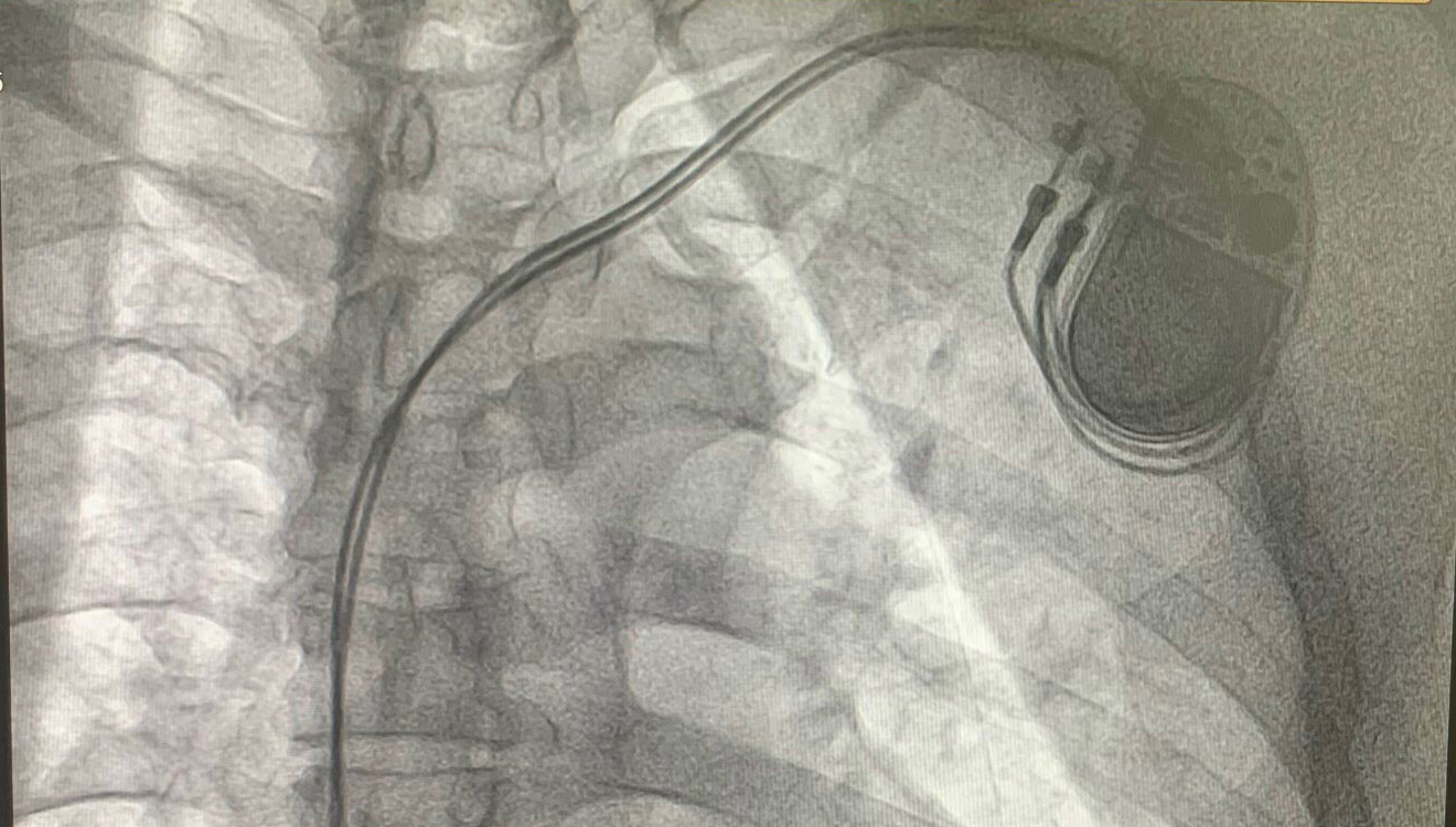 Cay May Tao Nhip Tim Vinh Vien 2