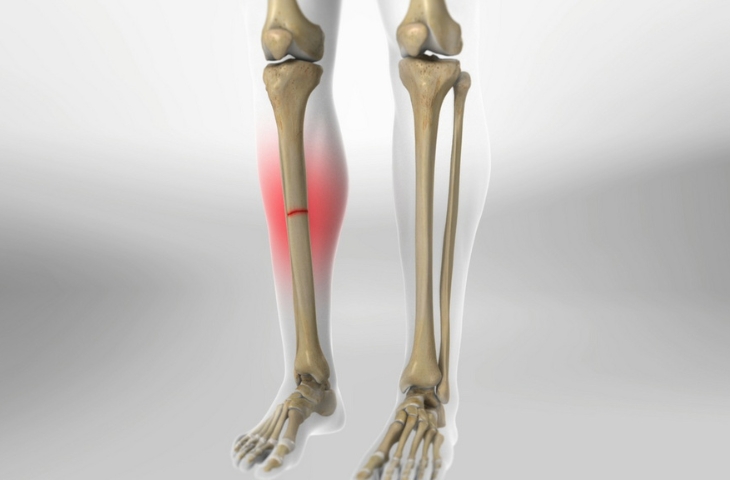 điều trị chấn thương thể thao bằng prp