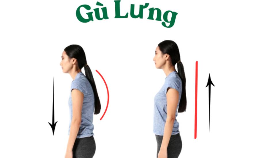 bài tập chống gù