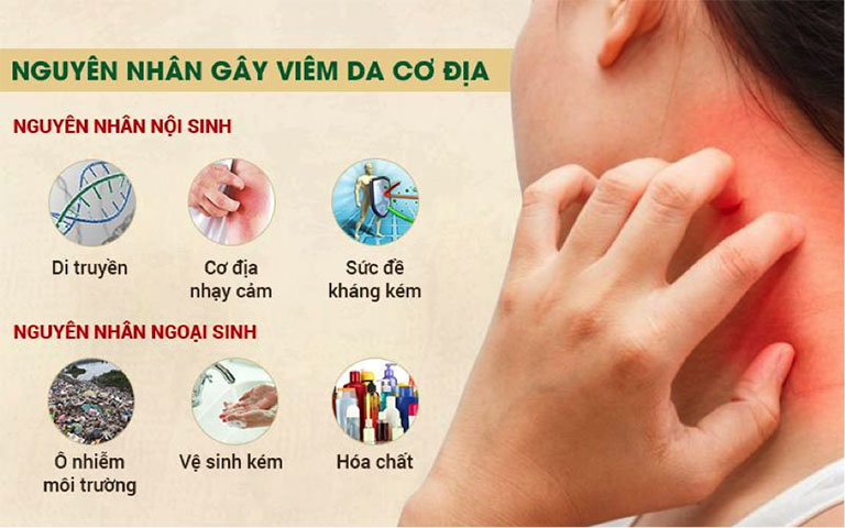 nguyên nhân gây viêm da cơ địa
