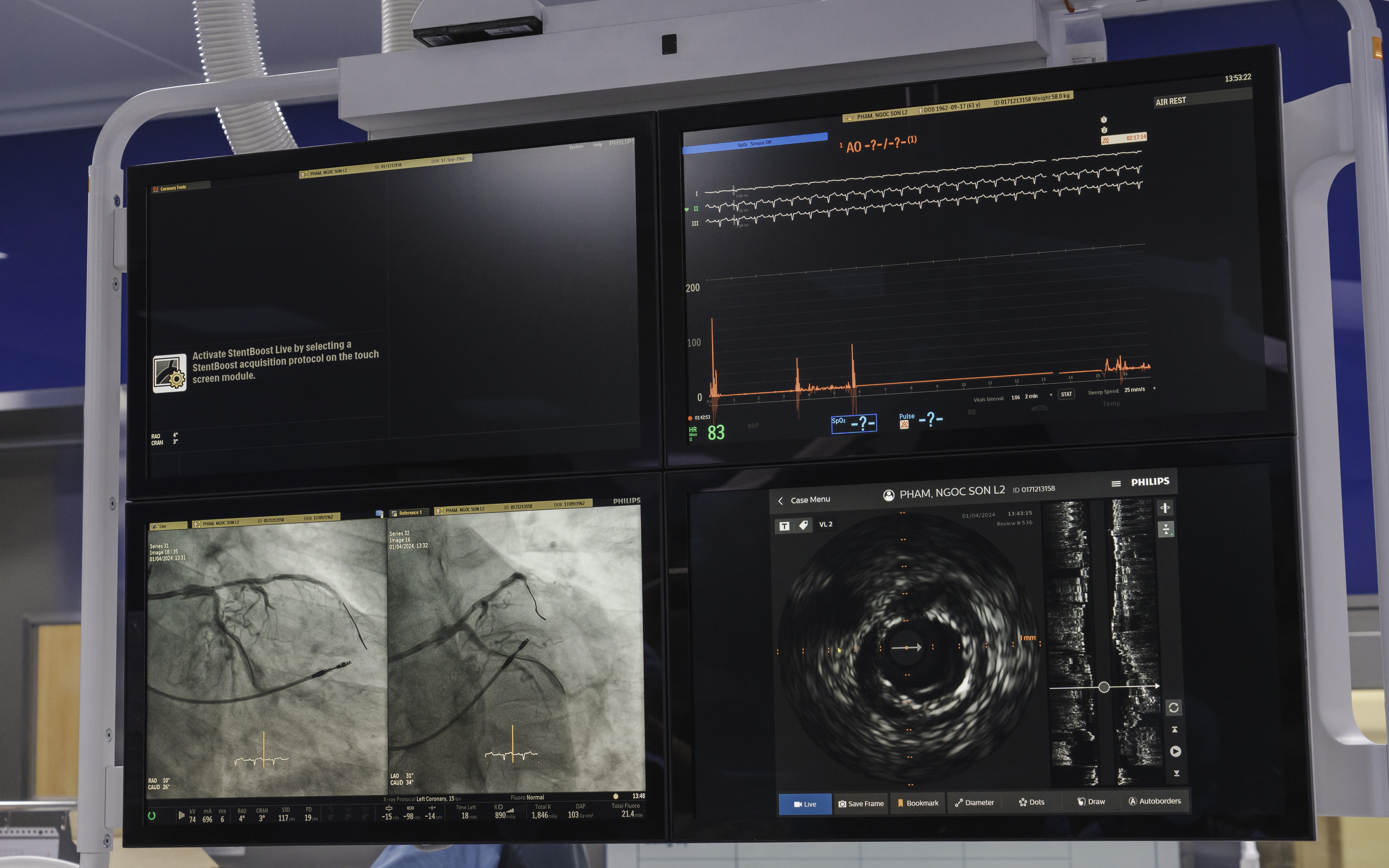 Sieu Am Trong Long Mach