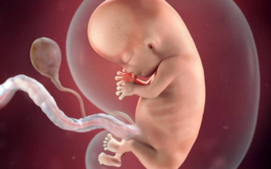 phẫu thuật thoát vị màng não tủy