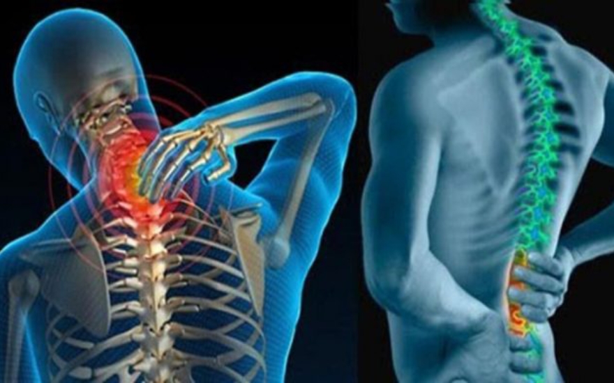 U xương cột sống