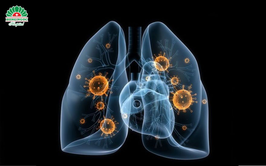 viêm phổi ở bé dưới 6 tháng tuổi