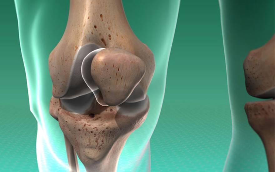 膝关节髌骨结构示意图