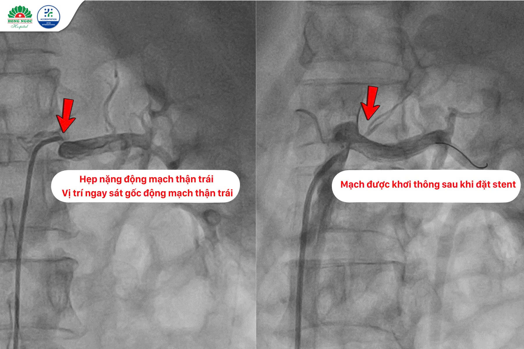 Z7041147212001 8d2c6b3ce740ae98176274448bca8a93