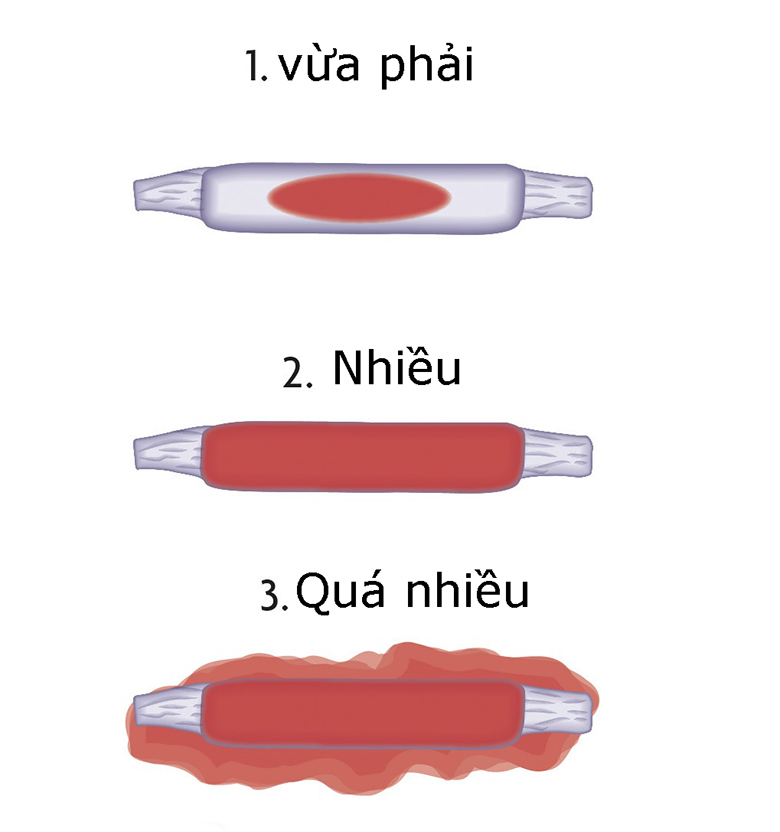 phá thai bằng thuốc