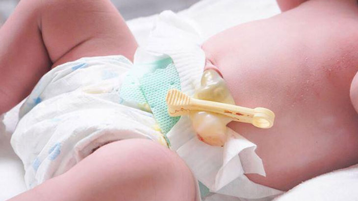 chăm sóc trẻ sơ sinh