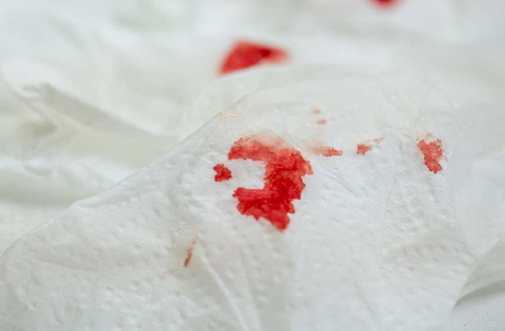 Băng huyết sau sinh