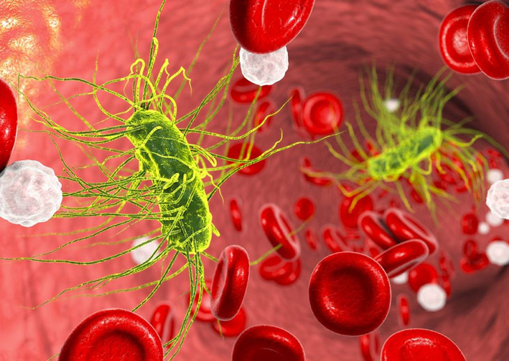 nhiễm khuẩn huyết