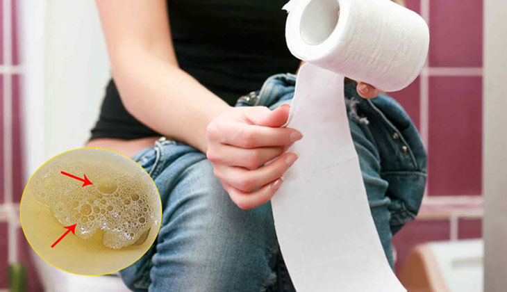 nước tiểu đục