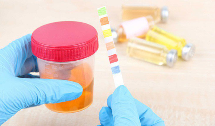 nước tiểu đục