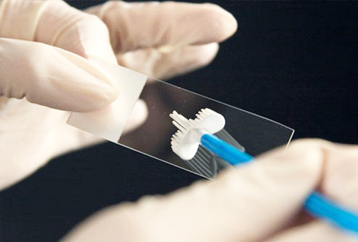 phết tế bào cổ tử cung