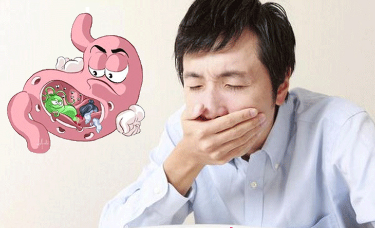 trào ngược dạ dày thực quản