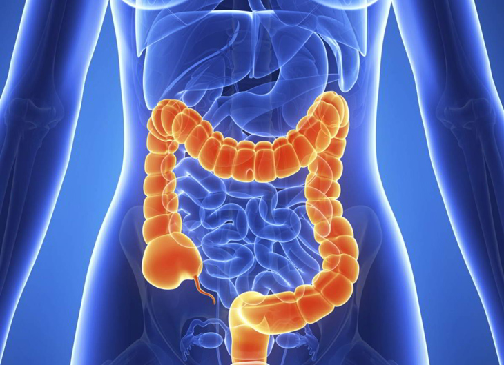 ung thư ruột già