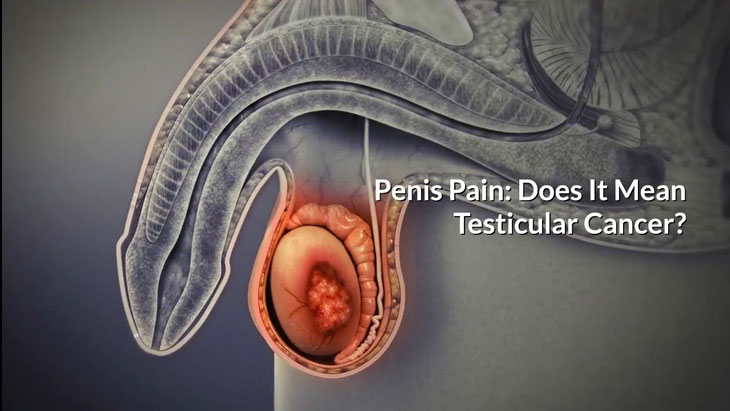 Vết thương dương vật