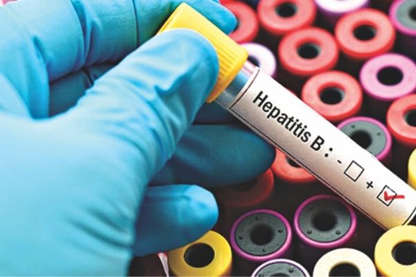 Lấy máu xét nghiệm kháng nguyên (hoặc kháng thể) bề mặt viêm gan B