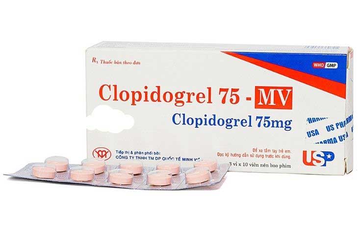 vữa xơ động mạch