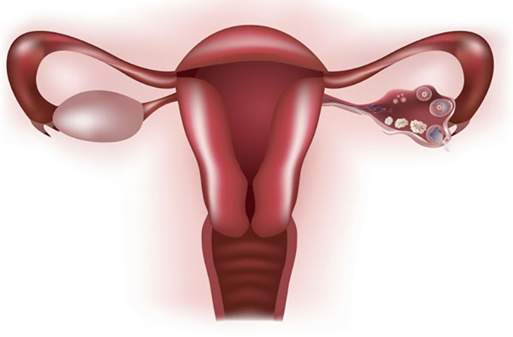 lao-hoa-buong-trung-som