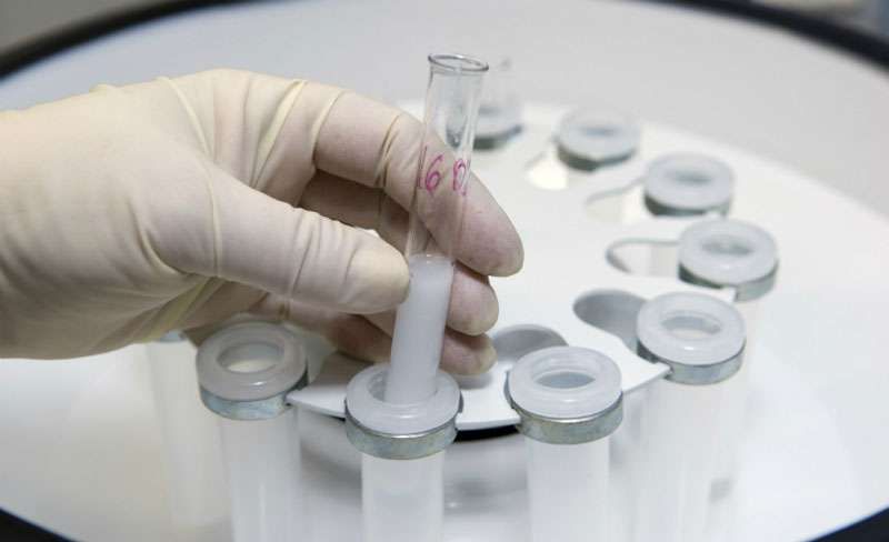 Tinh trùng sẽ được lọc rửa cẩn thận trong môi trường vô trùng trước khi bơm vào tử cung