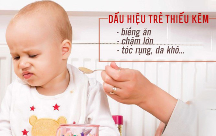 thiếu kẽm ở trẻ nhỏ