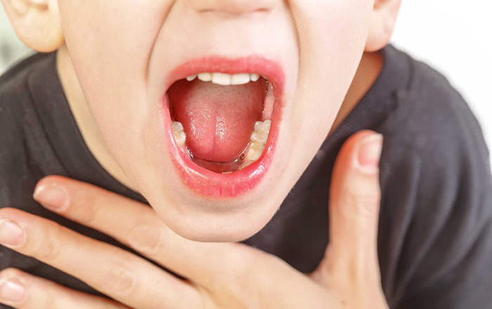 mổ amidan nạo VA