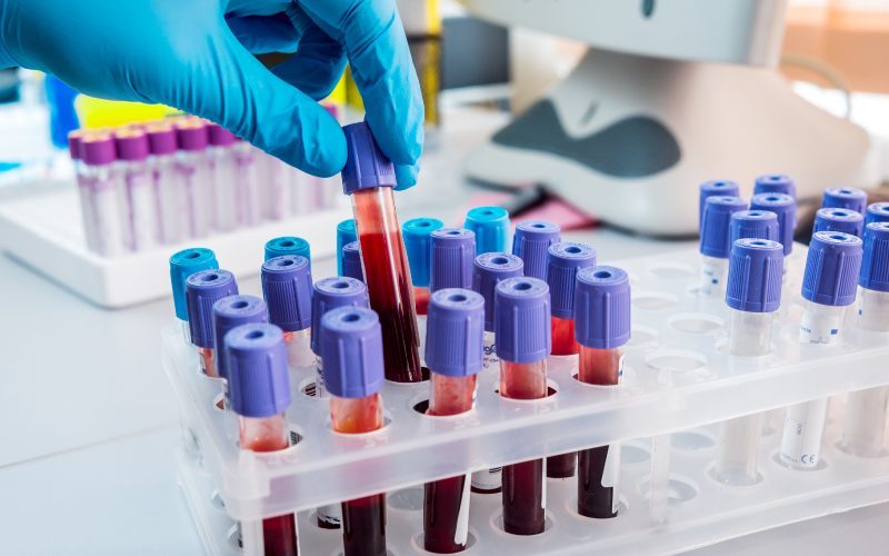 Xét nghiệm máu và nước tiểu khi mang thai