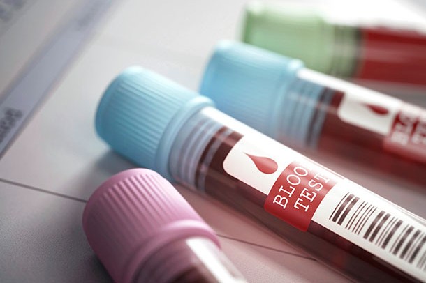 Xét nghiệm yếu tố máu Rh khi mang thai