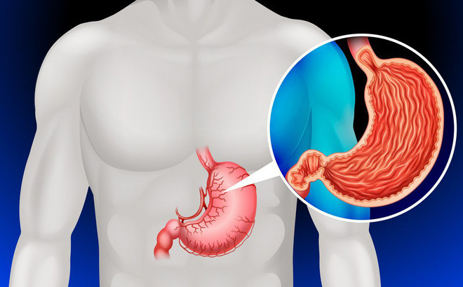 8 câu hỏi thường gặp về siêu âm dạ dày