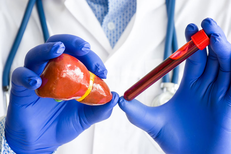 Nên đi xét nghiệm chức năng gan định kỳ để đánh giá sức khỏe của gan