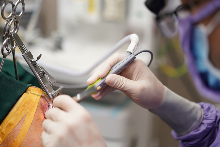 noi-nhiet-o-vom-hong