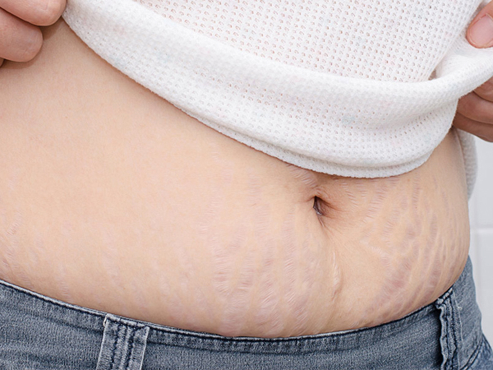 chăm sóc da bà bầu sau sinh