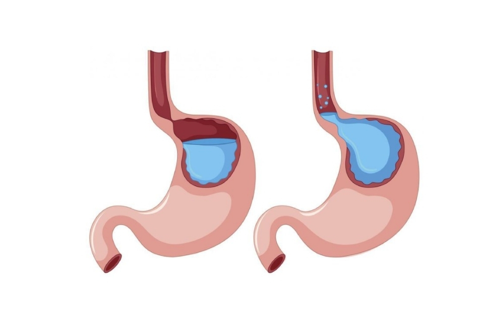 buon-non-chuong-bung