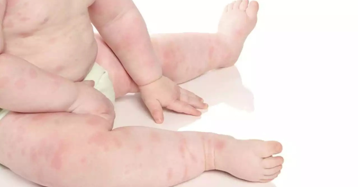 Sữa mẹ nóng hay mát?