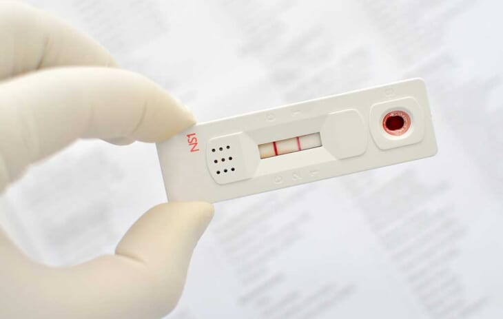 Xét nghiệm sốt xuất huyết tại nhà ở đâu uy tín nhất Hà Nội?