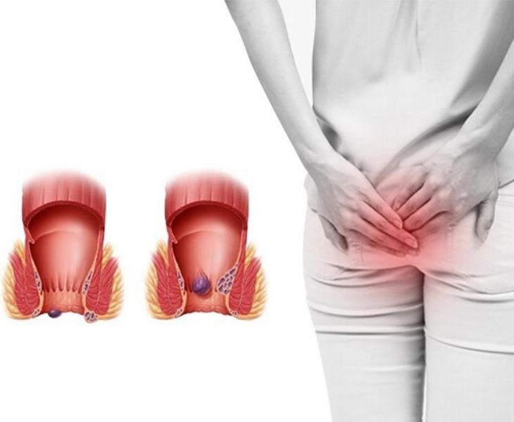 đi ngoài nhiều lần trong ngày