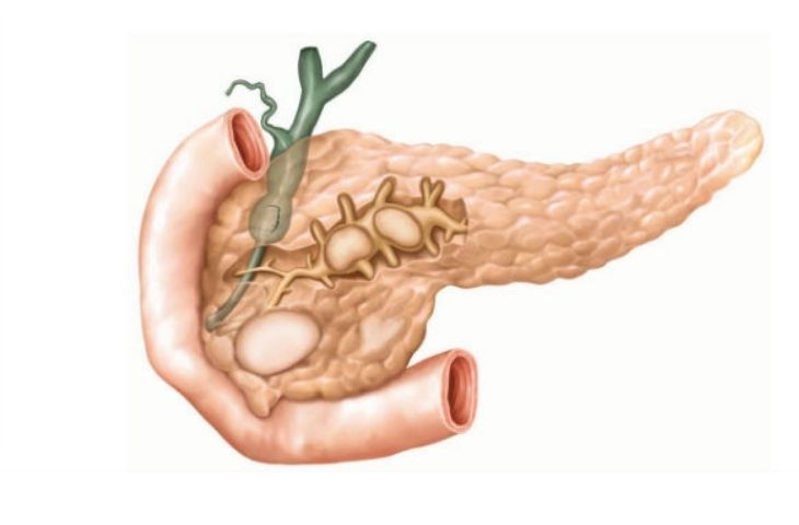 đi ngoài có bọt màu vàng