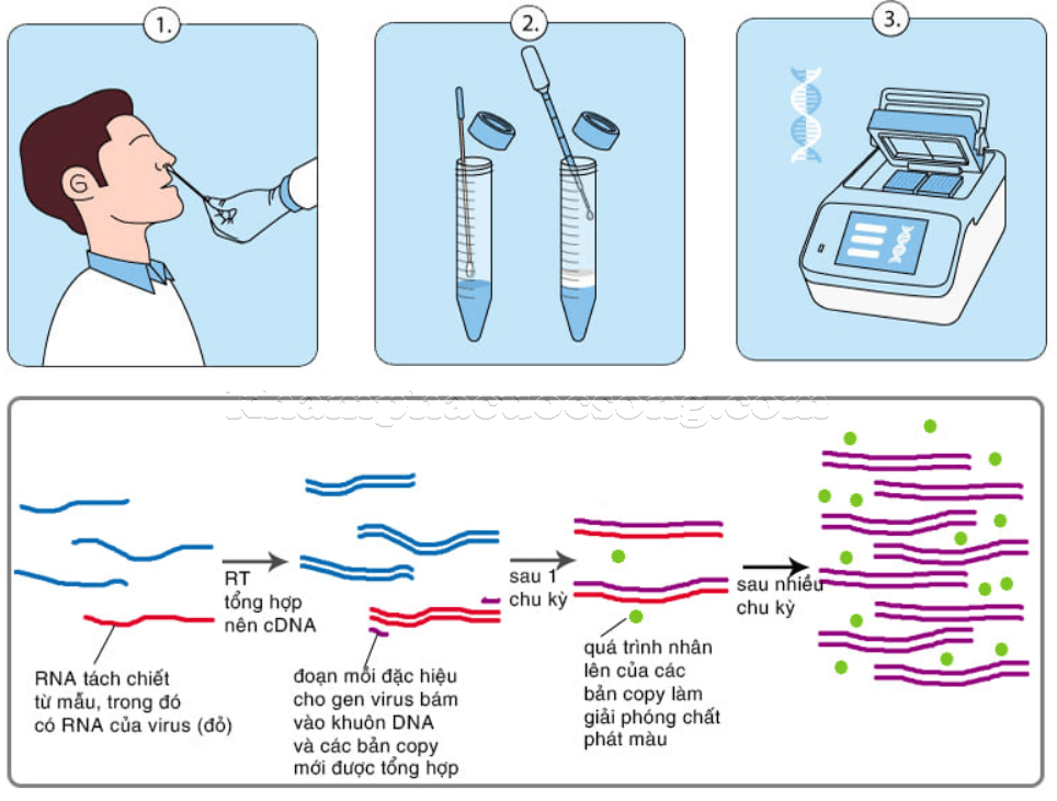 giá trị CT trong xét nghiệm RT PCR