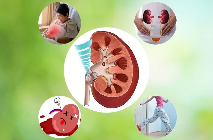 phẫu thuật sỏi thận