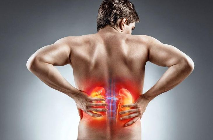 sỏi thận rơi xuống bàng quang