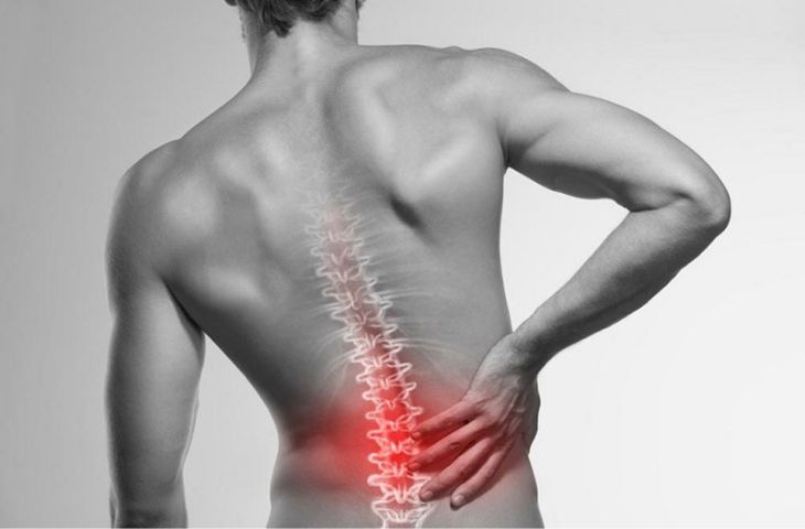 các giai đoạn thoát vị đĩa đệm