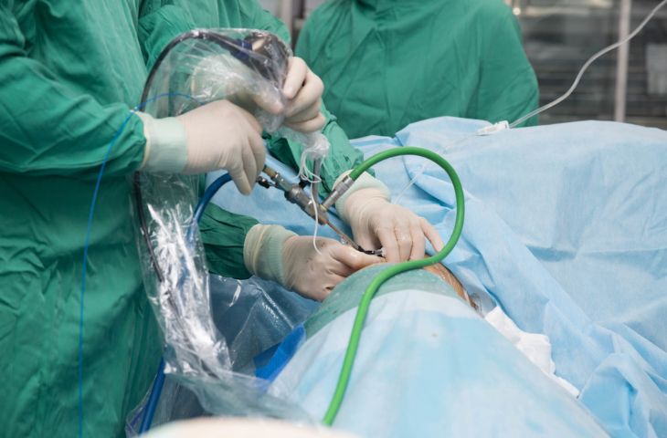 tán sỏi mật qua da