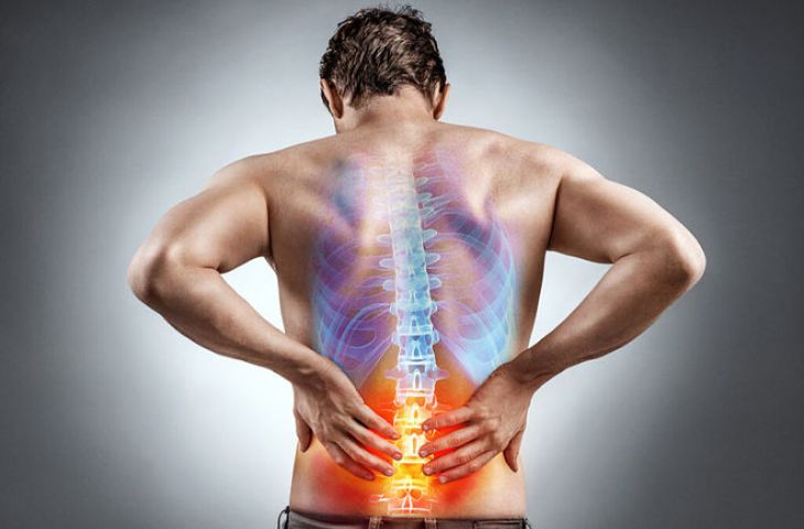 thoát vị nội xốp đĩa đệm