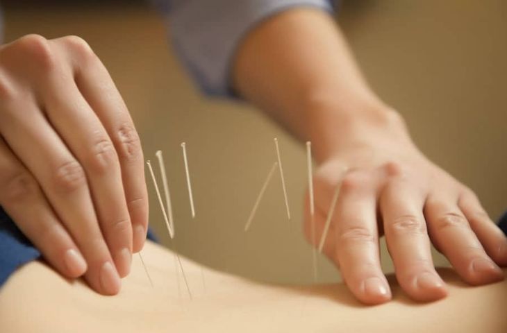 điều trị đau lưng cấp