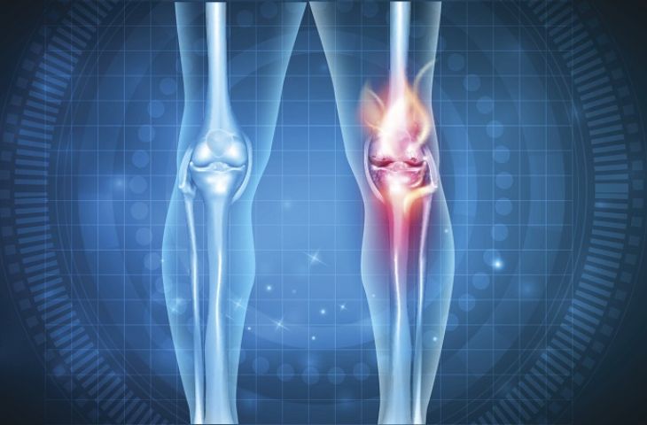 nguyên nhân đau lưng cấp